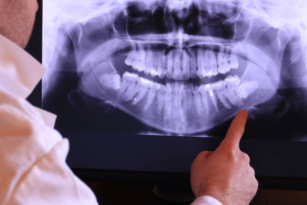 Best Urgent Tooth Repair  in Elkhart, TX